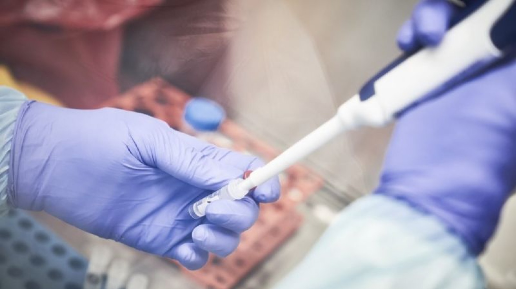 Argentina registra 101 fallecidos por coronavirus: 2.277 son los casos confirmados