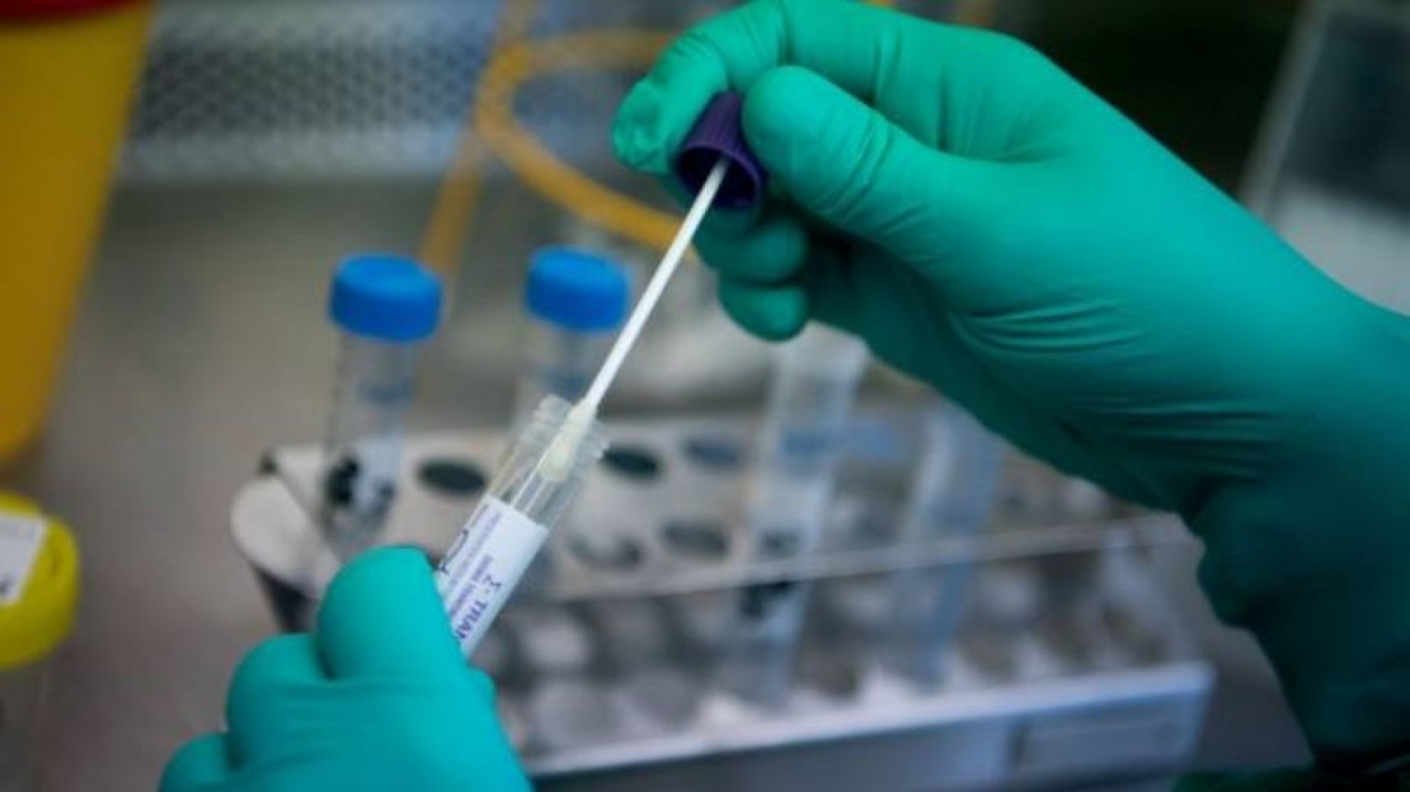 Científicos argentinos adaptaron un test para dengue para que pueda detectar el Covid19