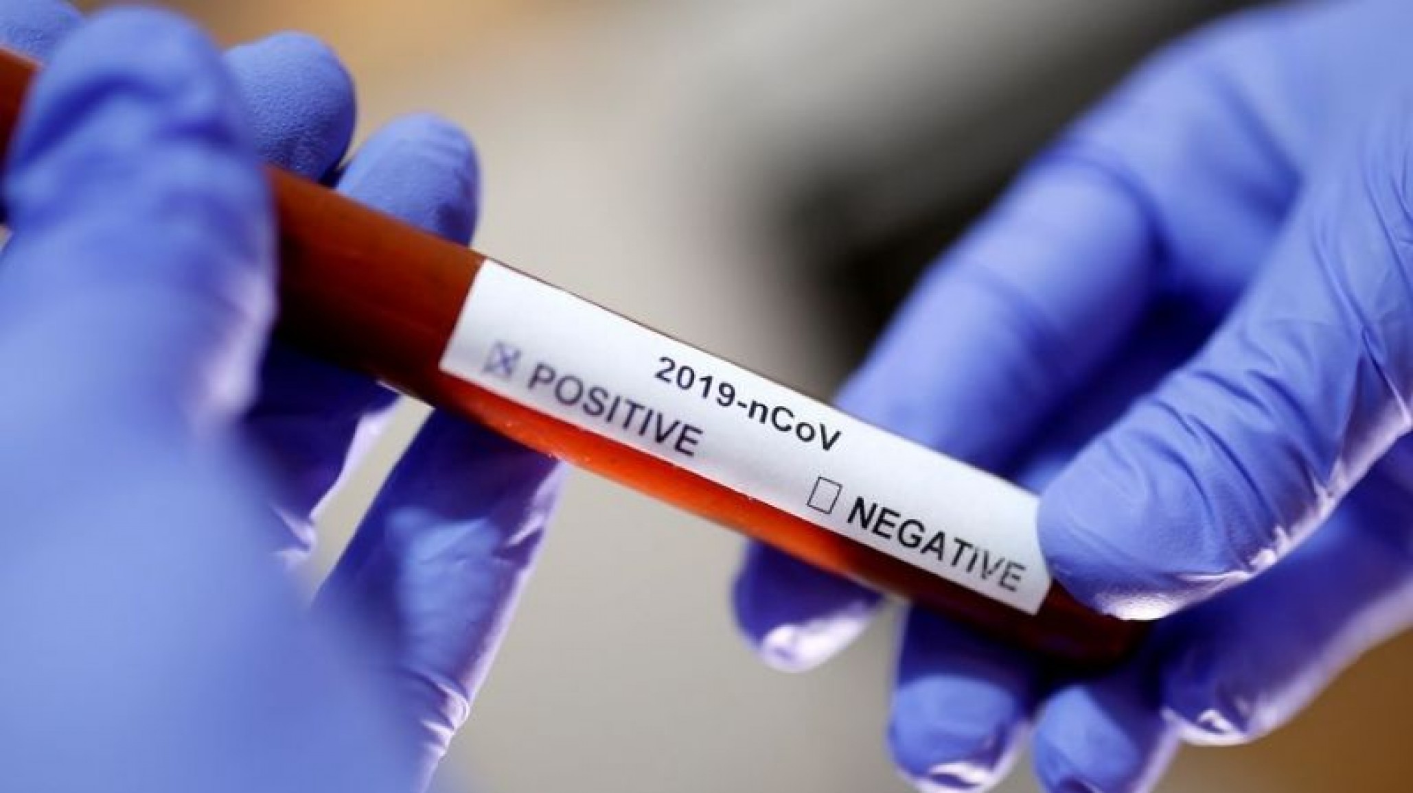 Coronavirus: Segundo caso confirmado en Chubut
