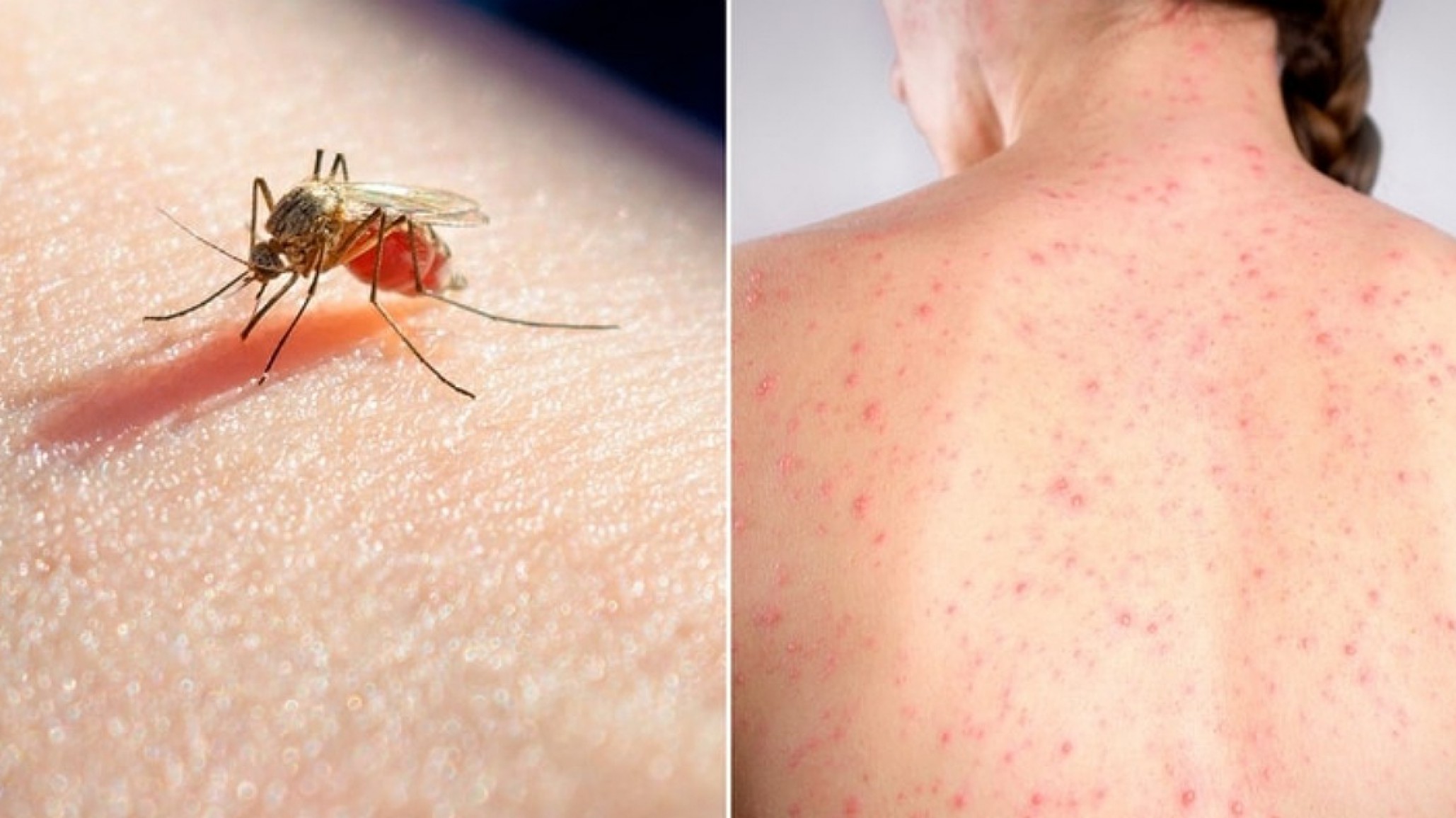 Más de 5.900 casos de dengue confirmados