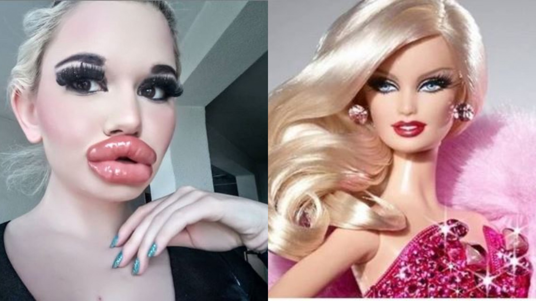 Más de 20 veces se inyectó botox para parecerse a Barbie