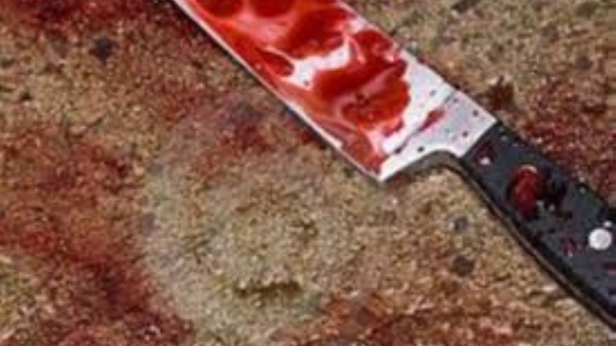 ¡Brutal! Con un cuchillo le desfiguraron la cara a una chica y debió recibir 25 puntos