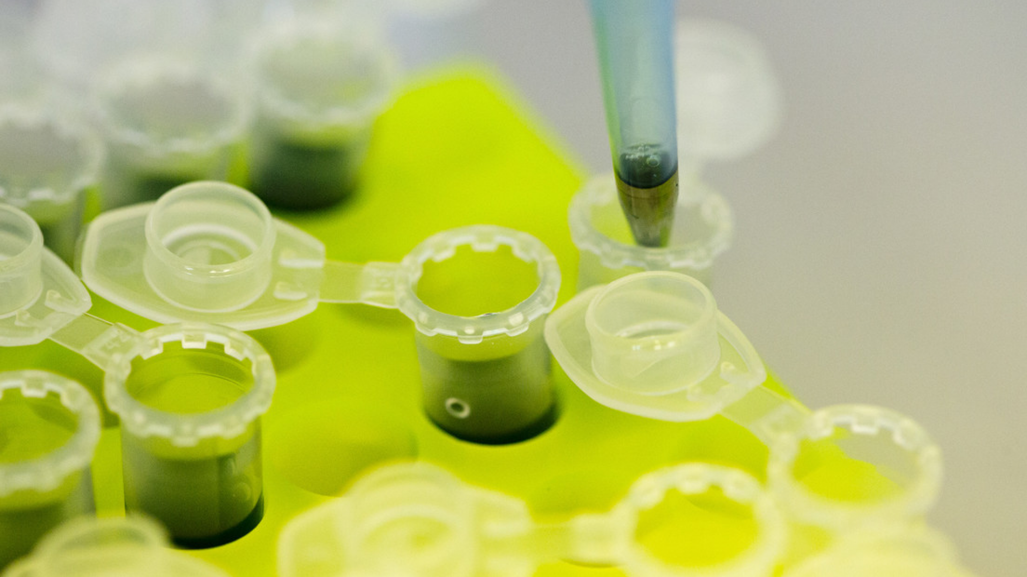 Coronavirus: científico millonario dice que encontró la cura