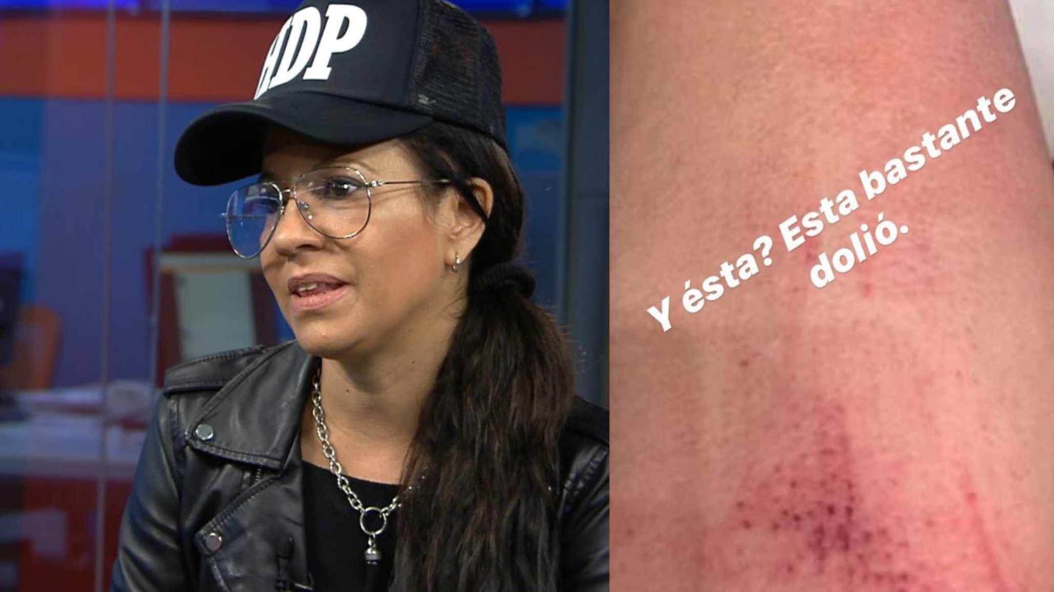 Miss Bolivia ¿denunció violencia de género con fotos de un robo en 2018?