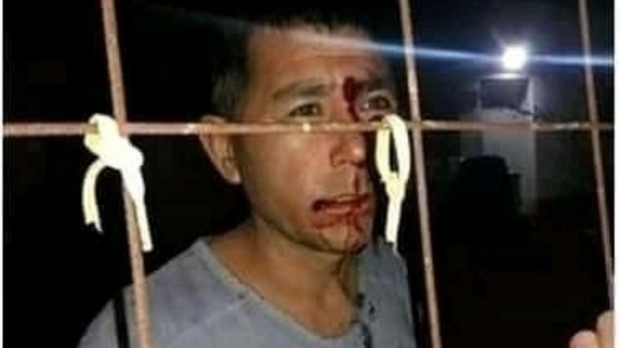 La víctima de brutalidad policial en Chubut aseguró que salió de su casa y le dispararon