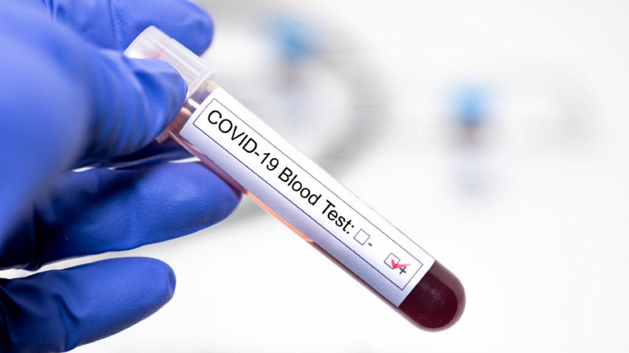 Comodoro: Confirman 10 nuevos casos positivos de Coronavirus