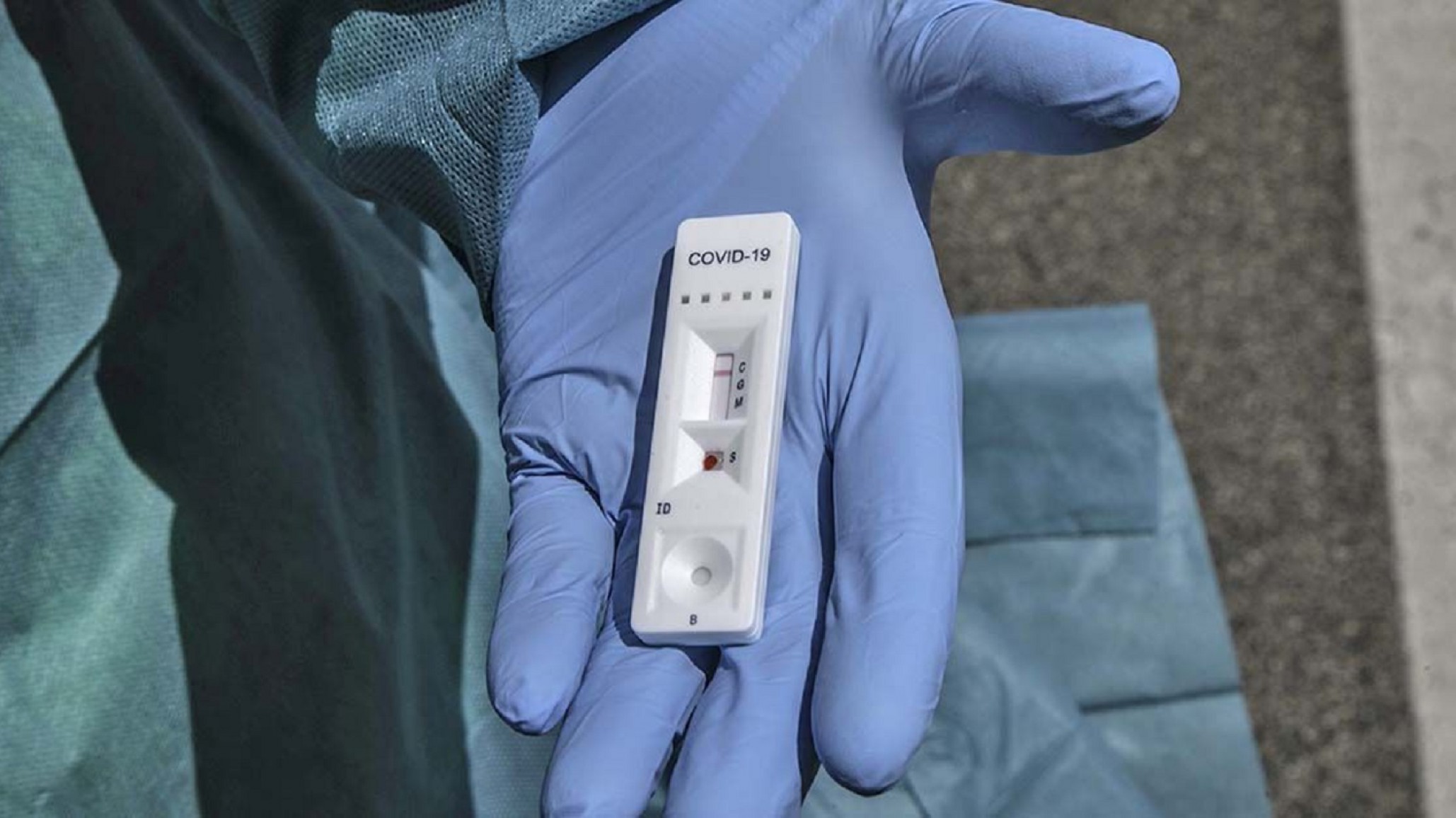 Ciudad de Buenos Aires: retiran 20.000 tests rápidos de Covid-19 defectuosos