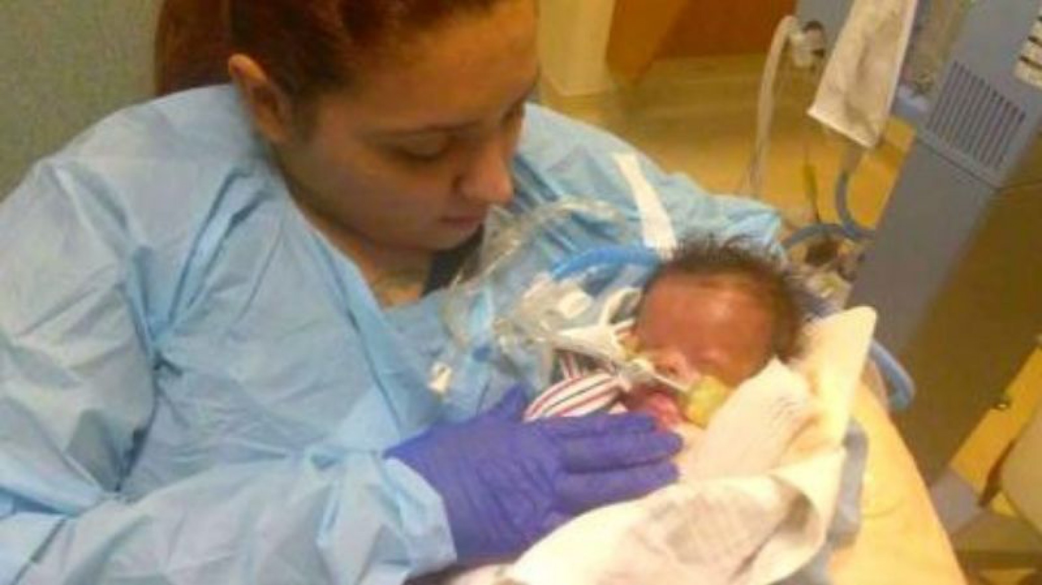 El caso del bebé que nació sin piel