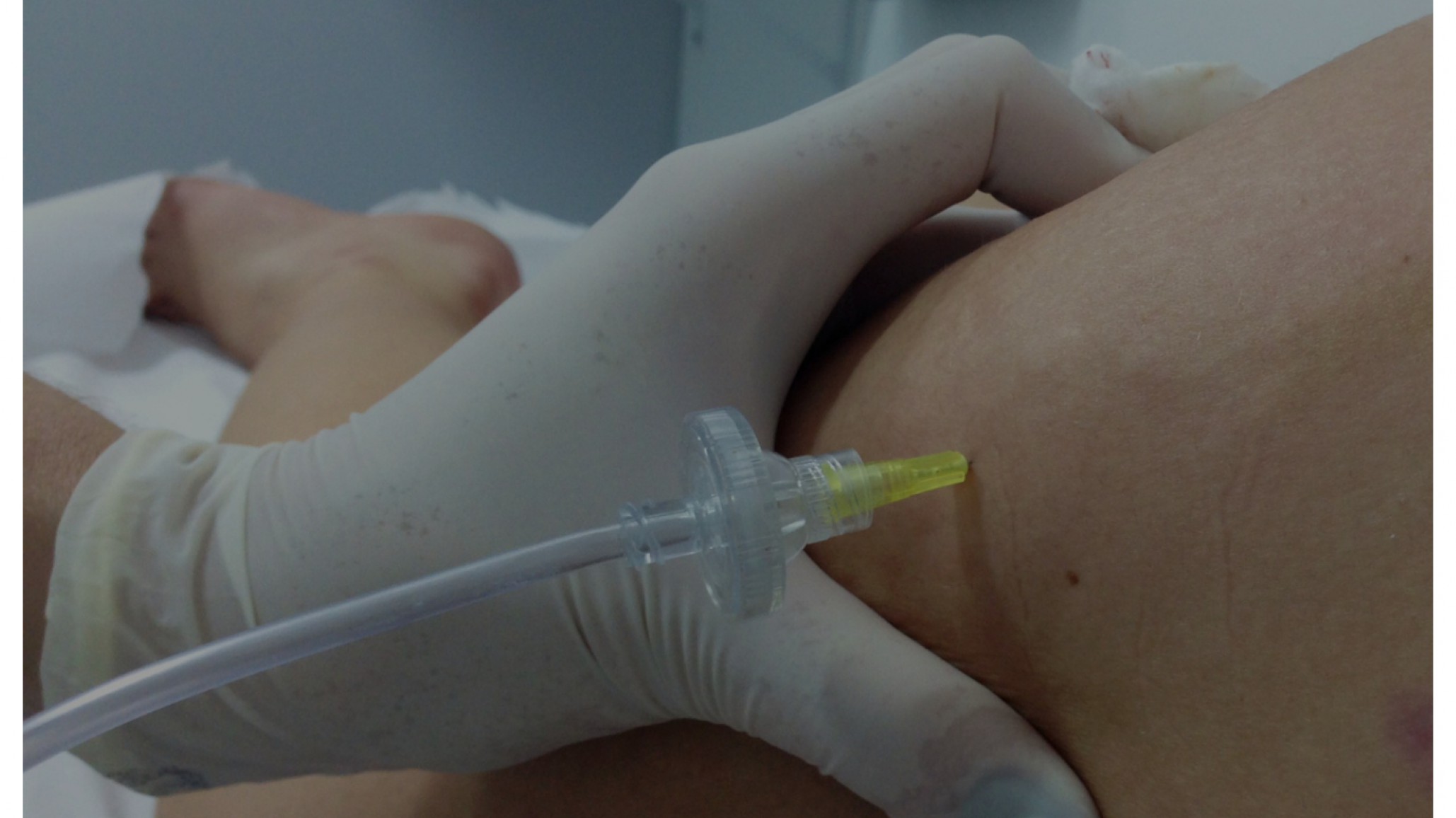 Una mujer se descompensó cuando se realizaba un tratamiento estético y murió