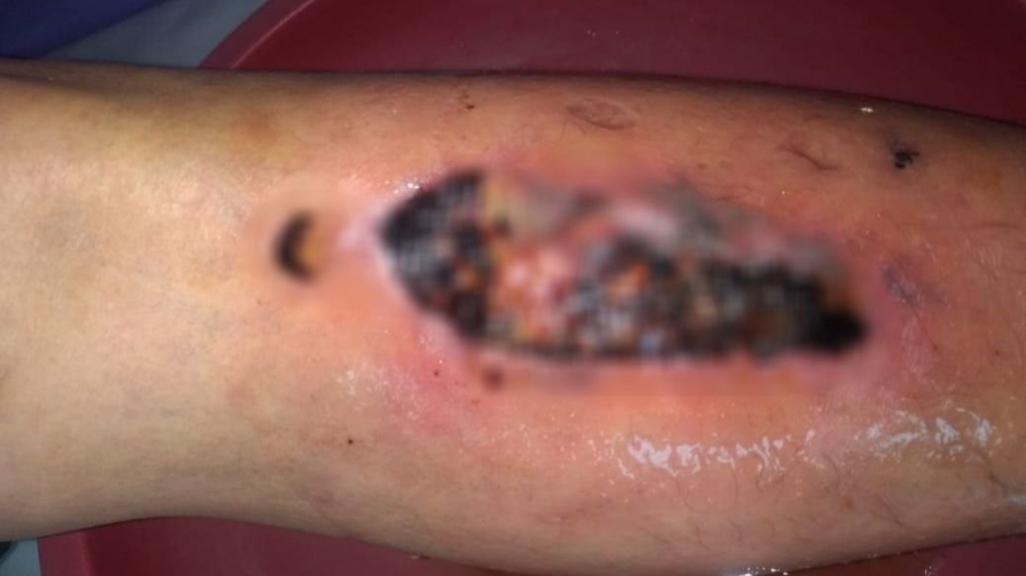 Encontraron a un trabajador con una herida en estado de descomposición e investigan un caso de explotación laboral