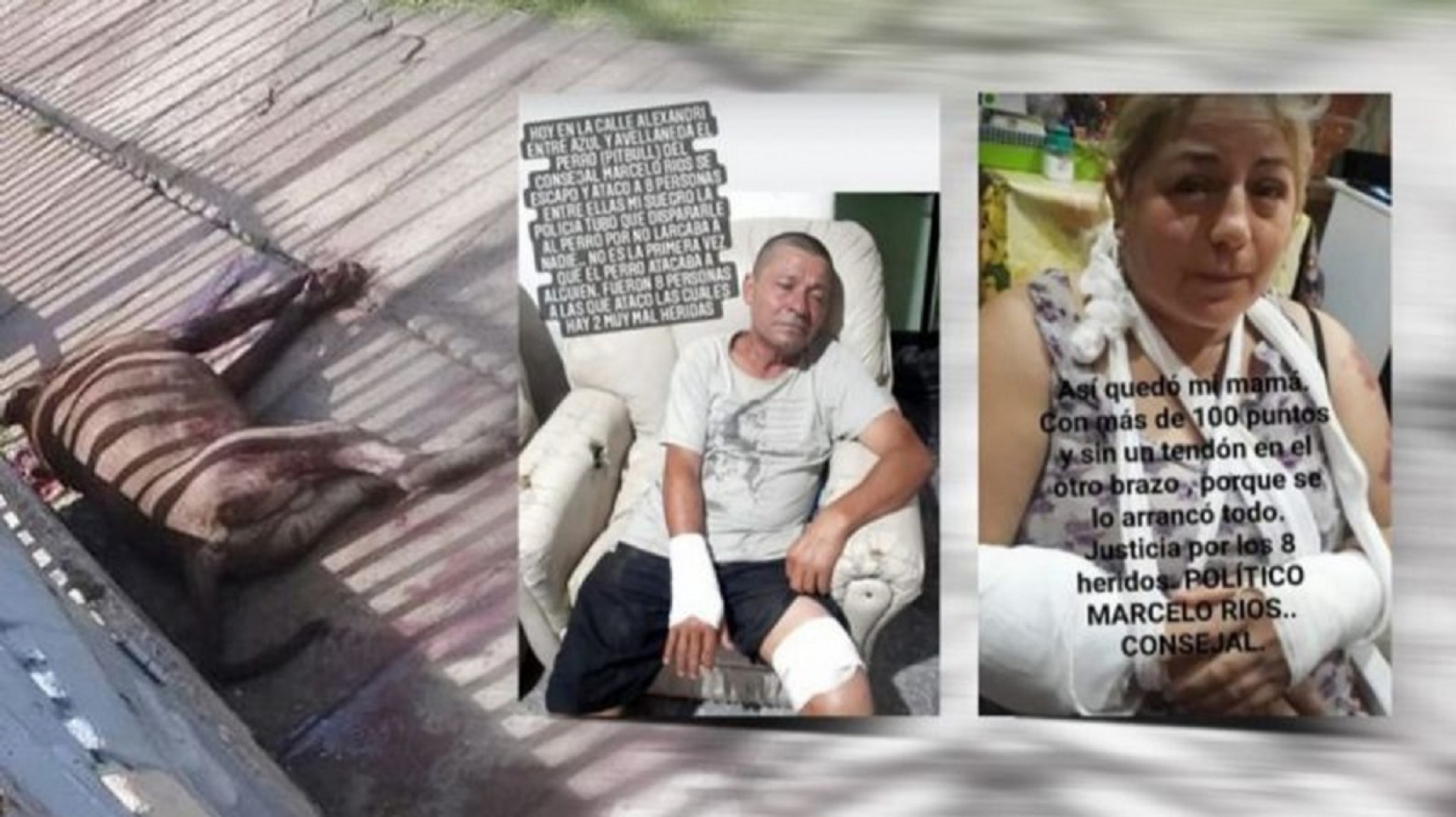 Ocho personas heridas tras ser atacadas brutalmente por un pitbull