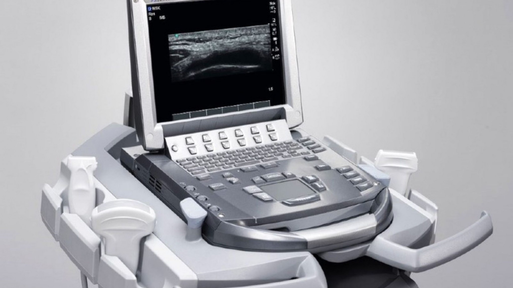 Anmat prohíbe la comercialización de de una serie de ecógrafos