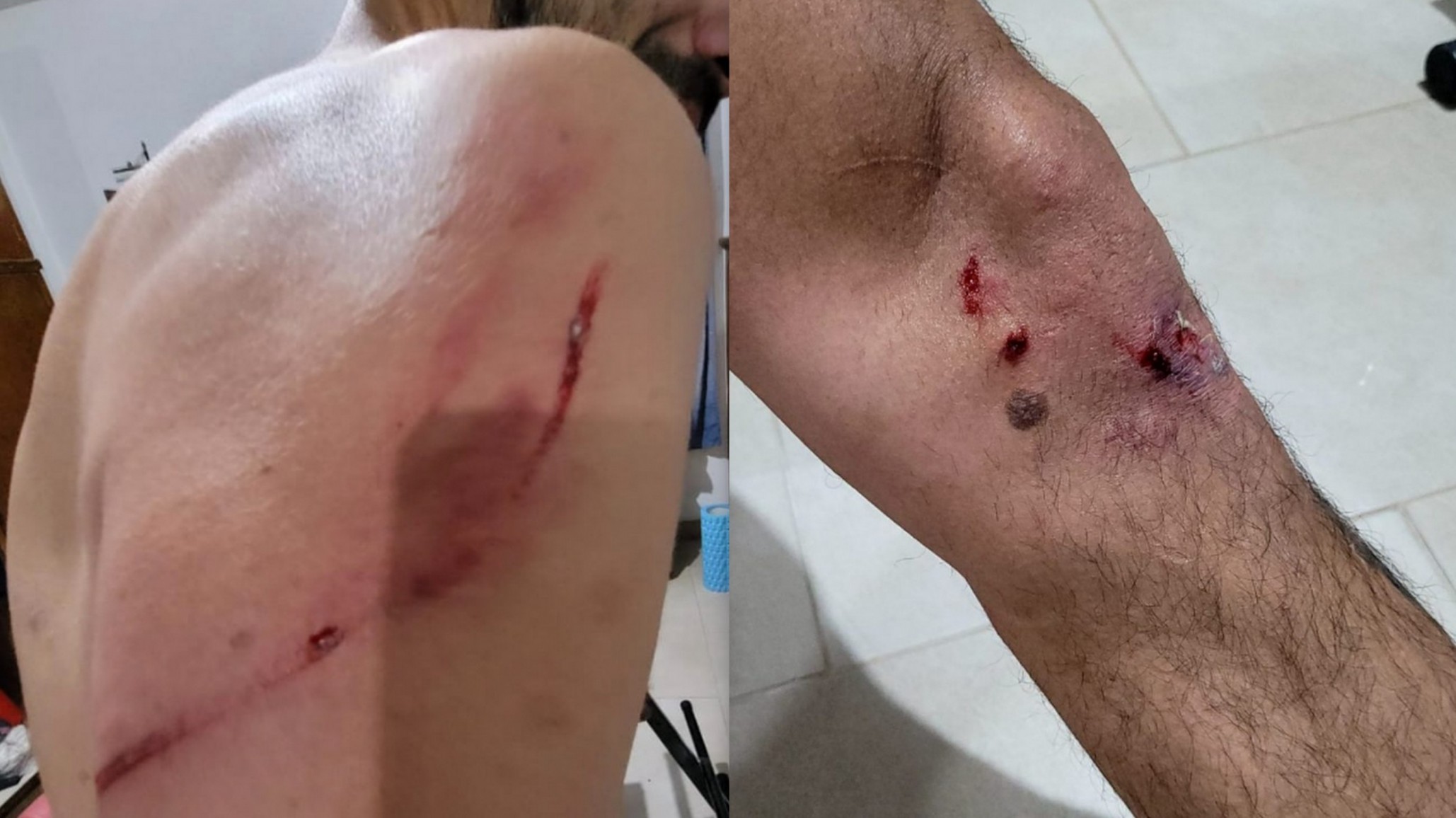 Un perro callejero lo atacó “por el golpe se me quebró la muñeca”