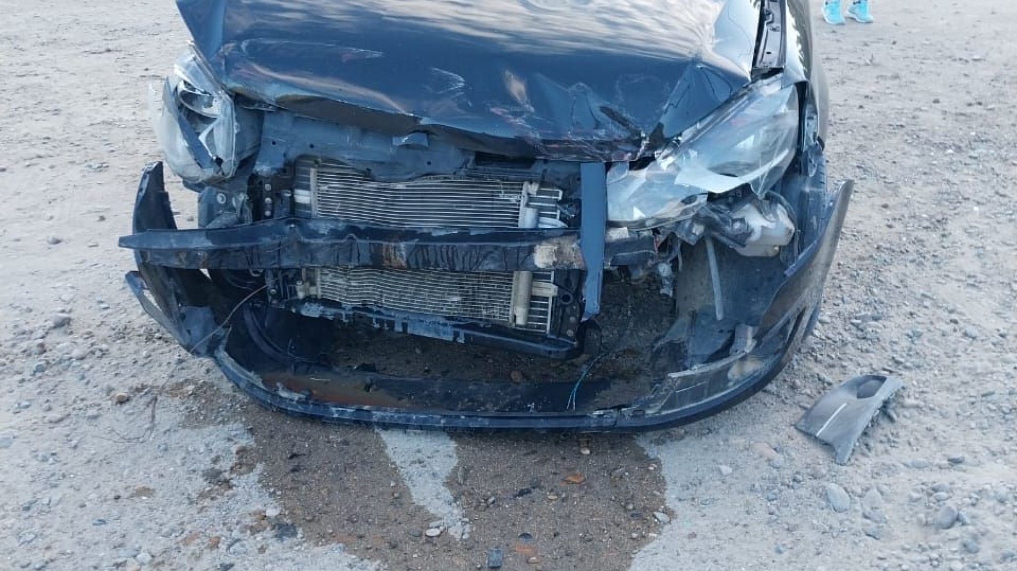 Tras un choque dos niños terminaron lesionados