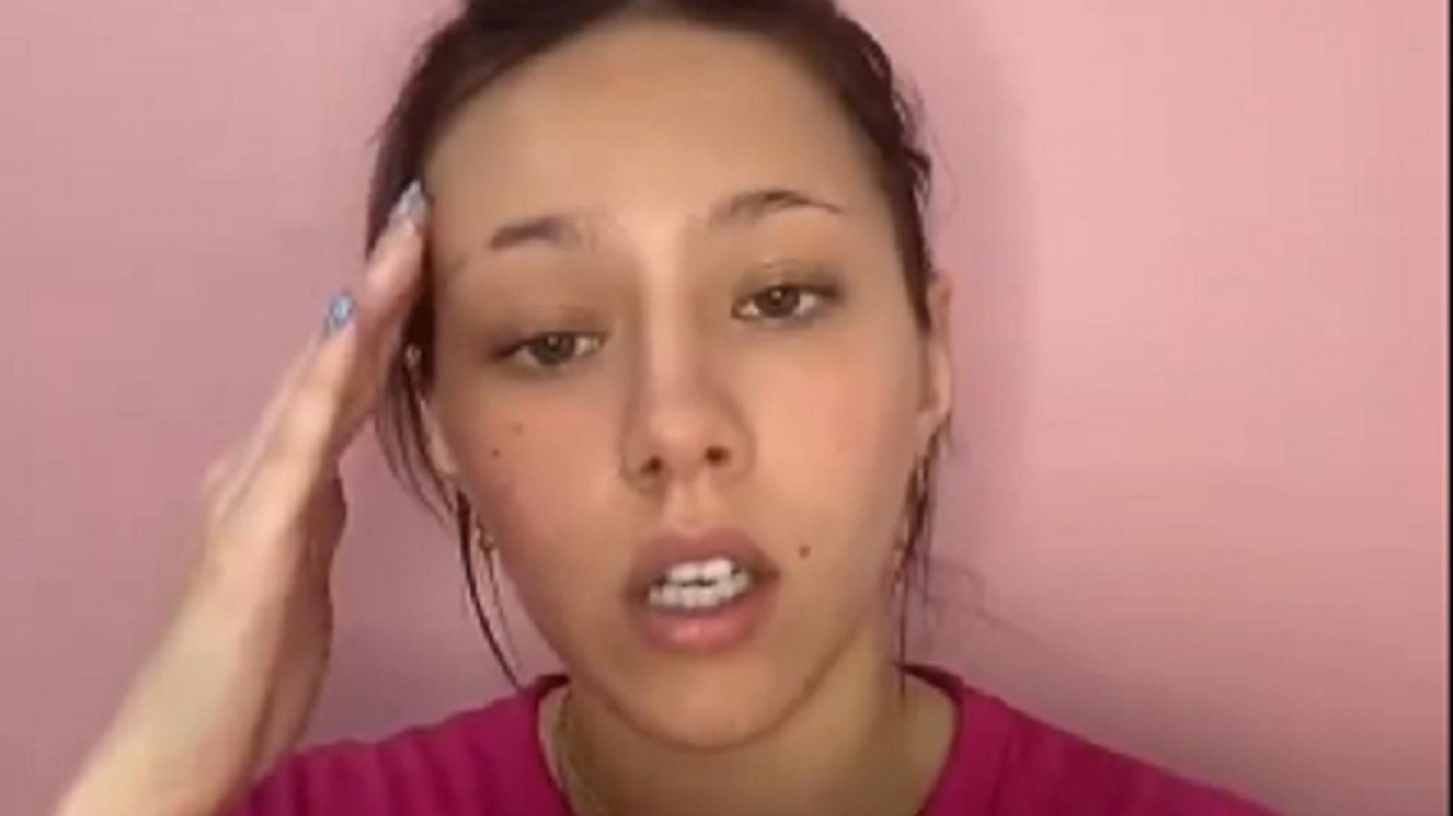 Video: Joven necesitaba urgente una placa de titanio para su operación en la cabeza y ocurrió un milagro