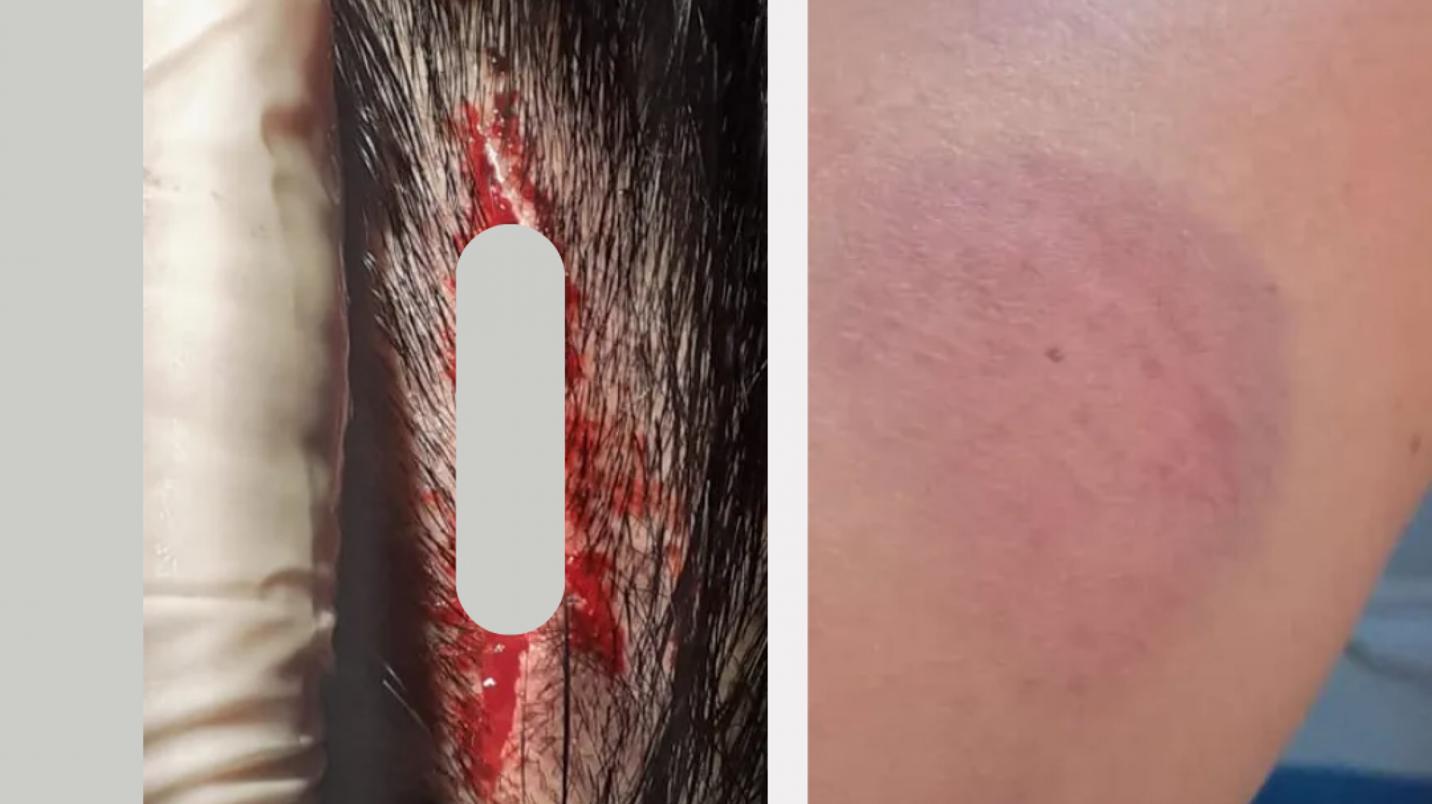 Denuncian violenta agresión de familia a vecinos del barrio Padre Corti