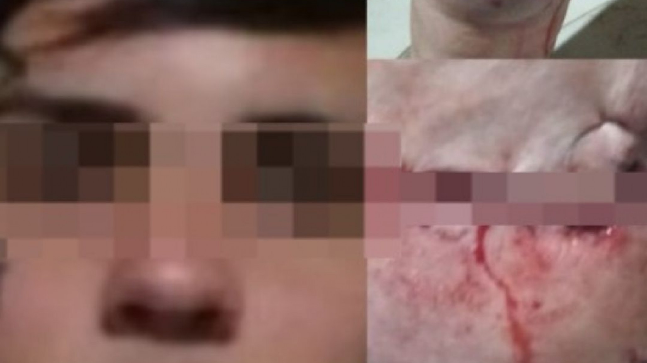 Un chico mató a un pitbull que mordió a su madre y luego golpeó salvajemente al dueño que tiene fractura de cráneo