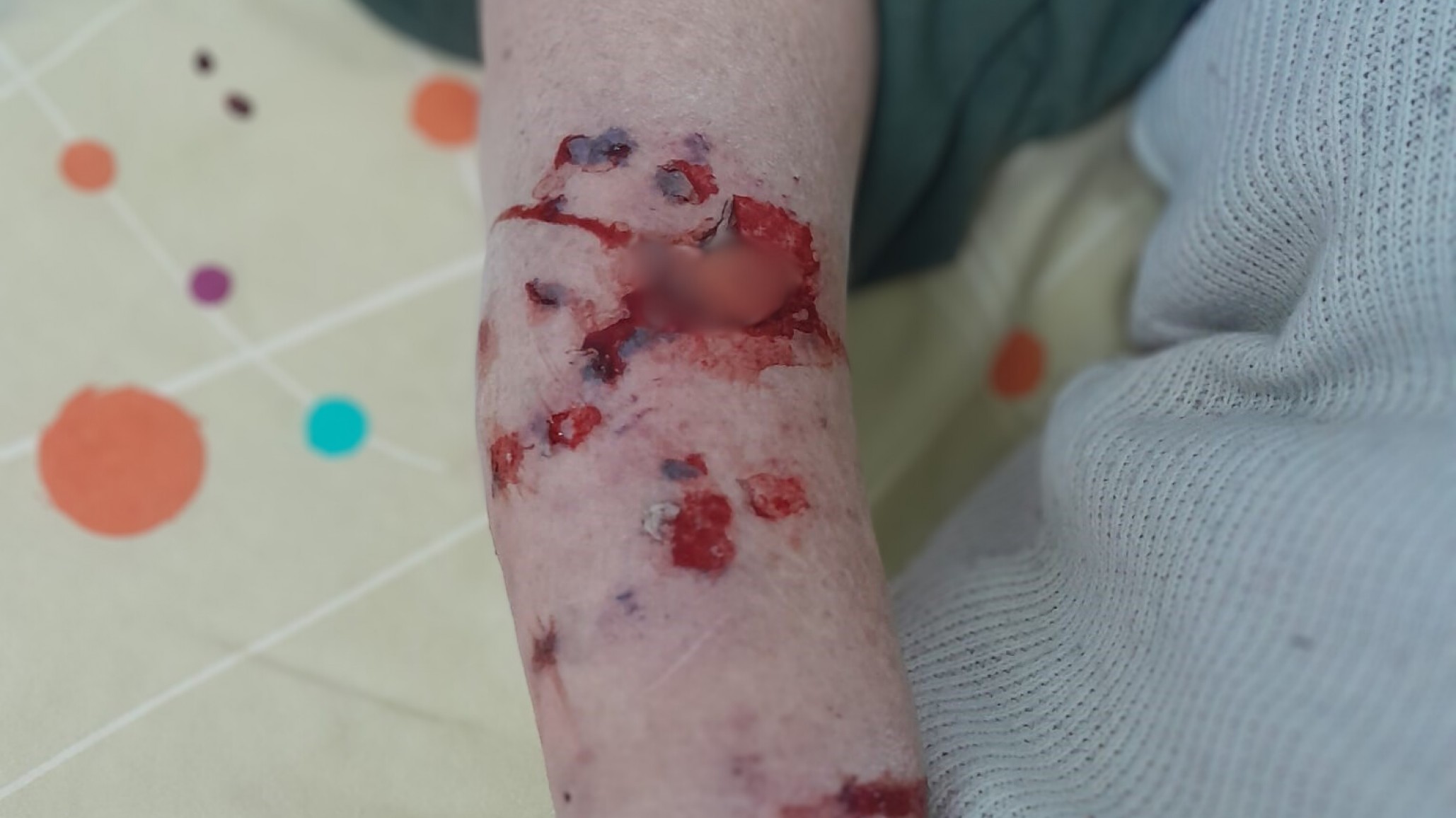 Brutal ataque de un perro a una mujer mayor: "Esta vez fue gravísimo"