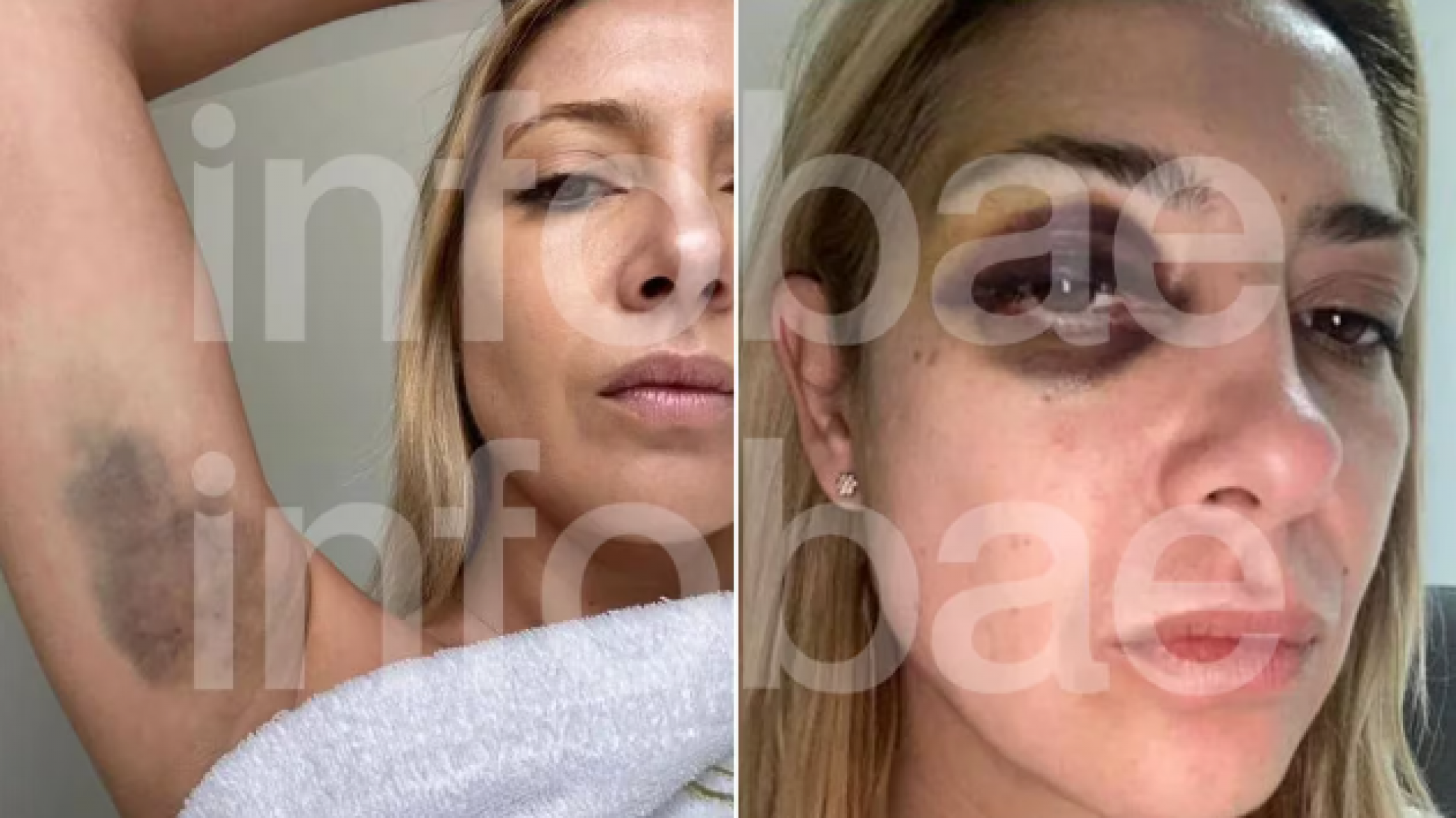 Fabiola Yañez habló tras la denuncia "Mucha gente sabía que esto pasaba"