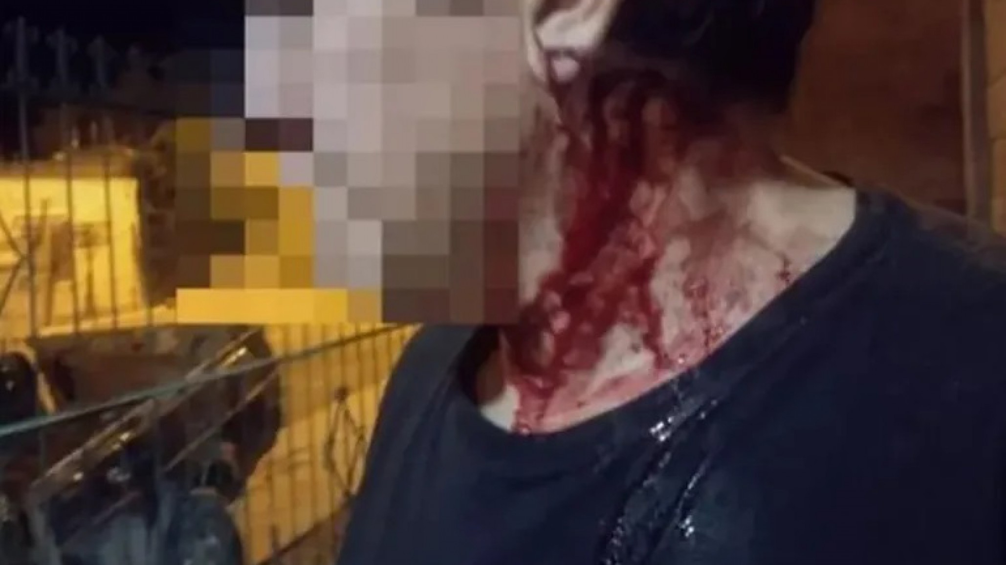 "Mi hijo intentó degollarme": Un hombre quiso matar a su papá en Trelew