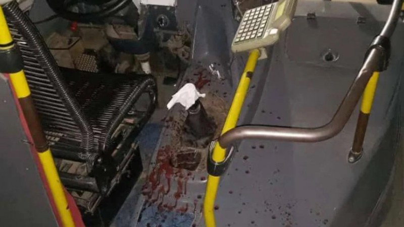 Brutal asalto a un chofer de colectivo: Le cortaron los dedos con un machete