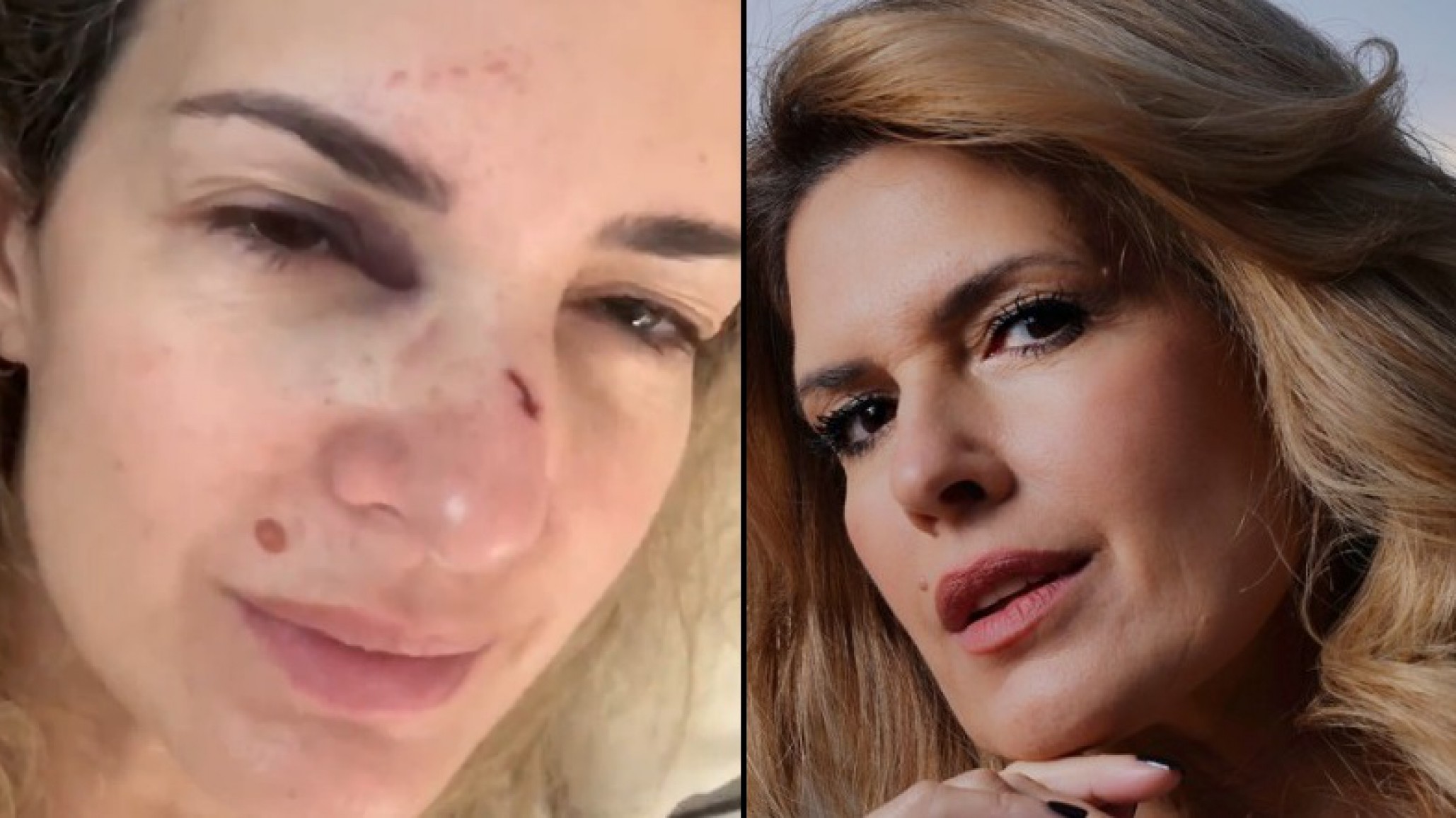 Isabel Macedo sufrió un fuerte accidente en los ensayos de Margarita