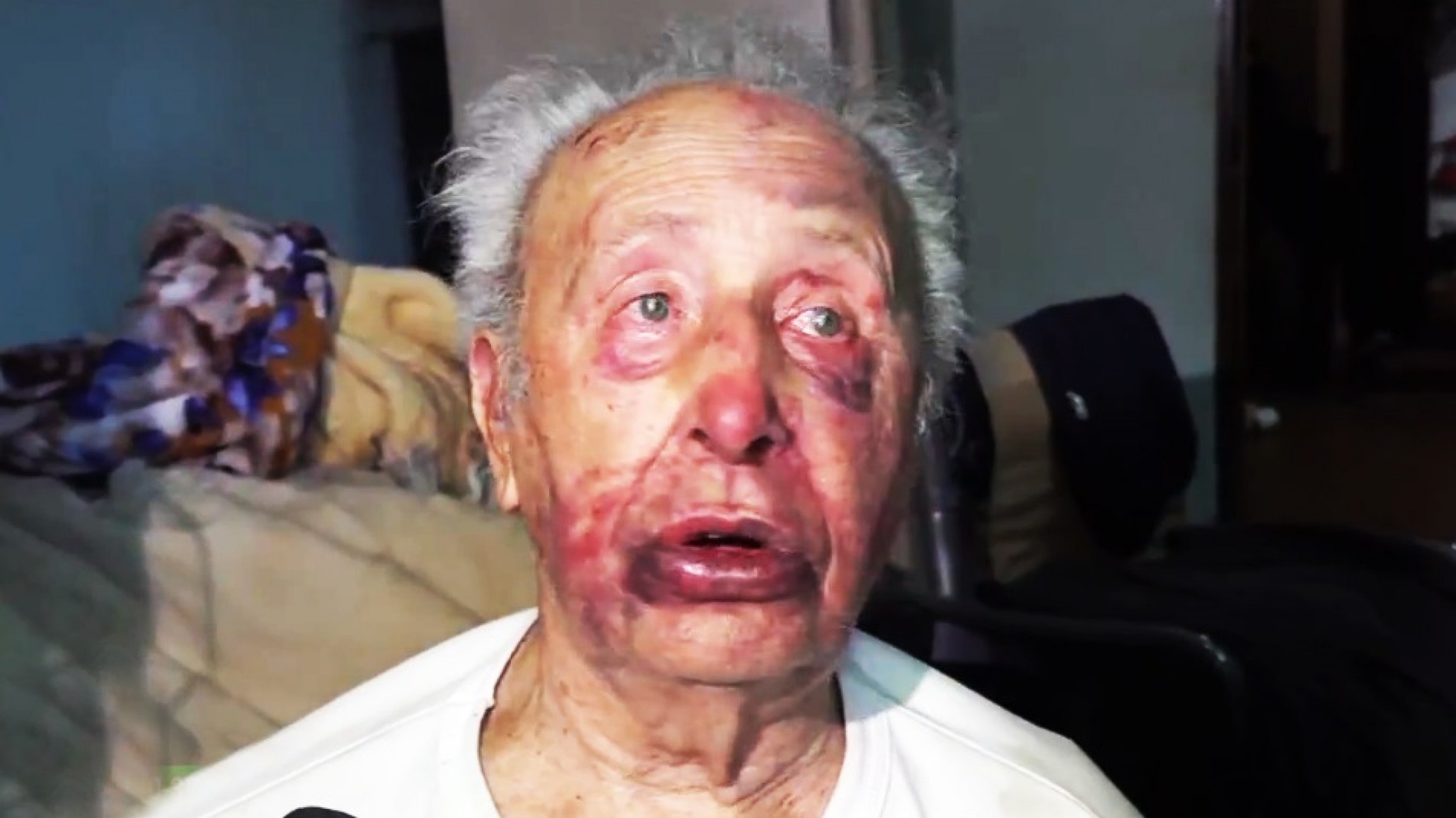 Un jubilado de 88 años fue golpeado y maniatado en un fuerte robo