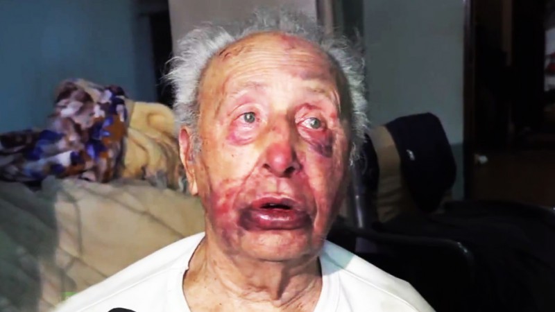 Un jubilado de 88 años fue golpeado y maniatado en un fuerte robo