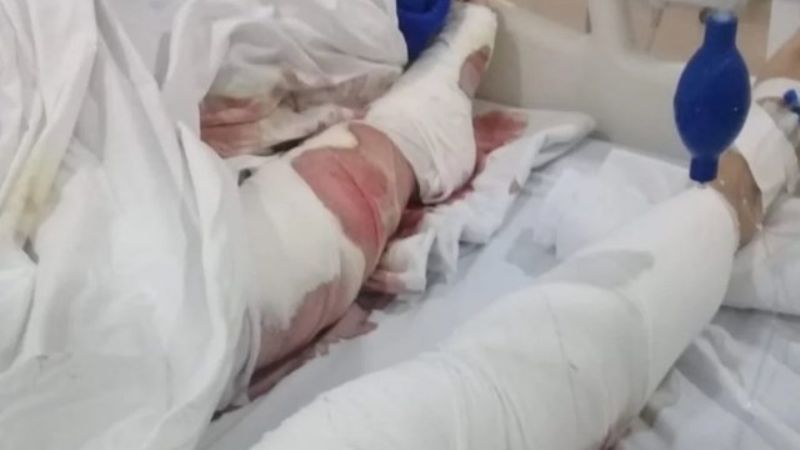 Tres perros atacaron a una mujer: se metió al mar para salvarse