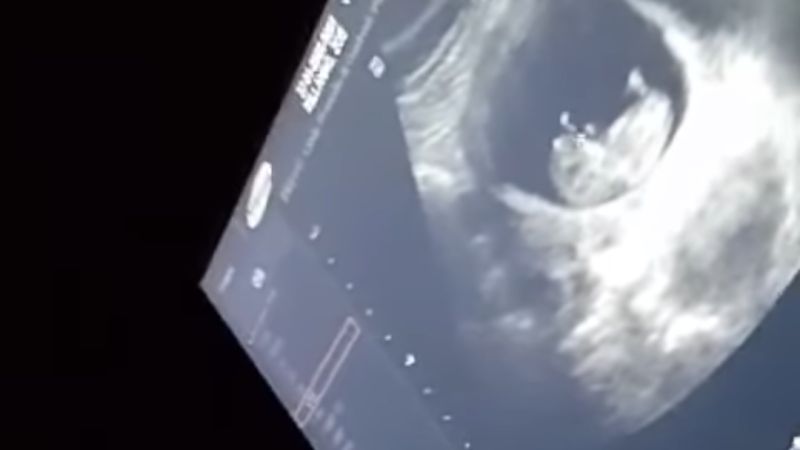 La mamá del joven apuñalado mostró la ecografía del nieto: "La salvación de mi hijo"