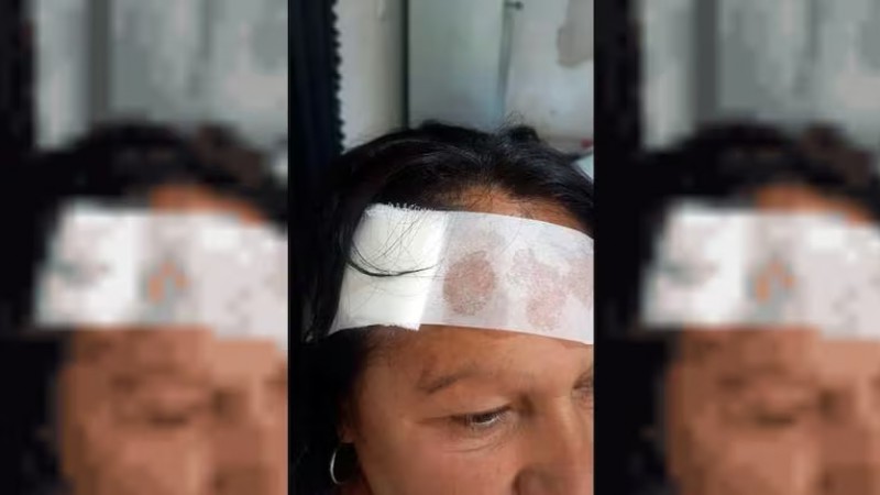 Violento robo a una mujer de 60 años: fue atacada y terminó con la muñeca fracturada