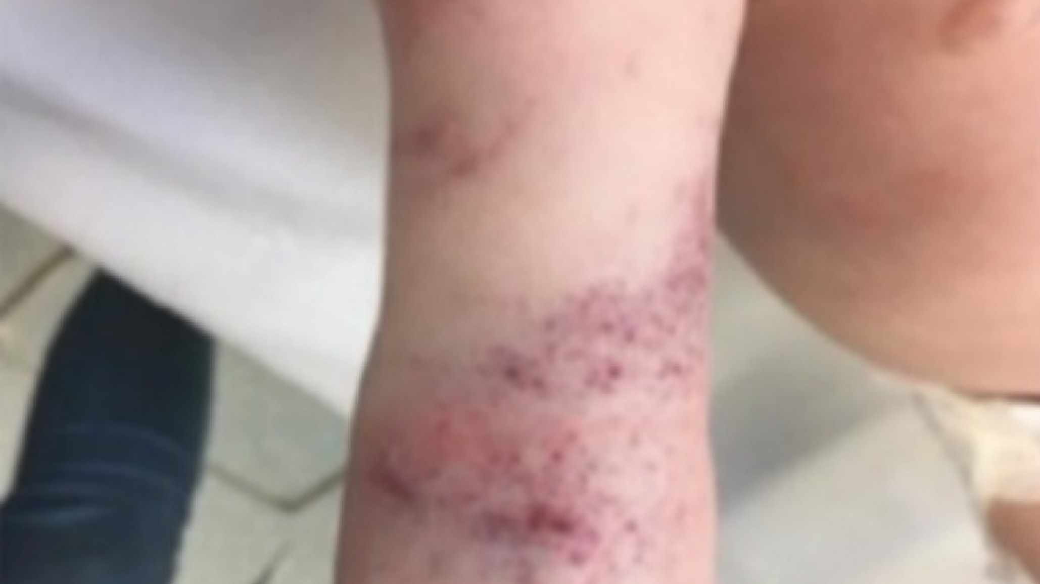 Sobreseyeron al padre que le pegó una brutal golpiza con un cinturón a su hijo por romper una copa de su novia