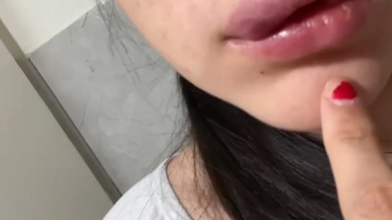 Grave denuncia contra un profesor de taekwondo: "Le desfiguró la cara a mi hermana y la tiró en un descampado con su bebé"