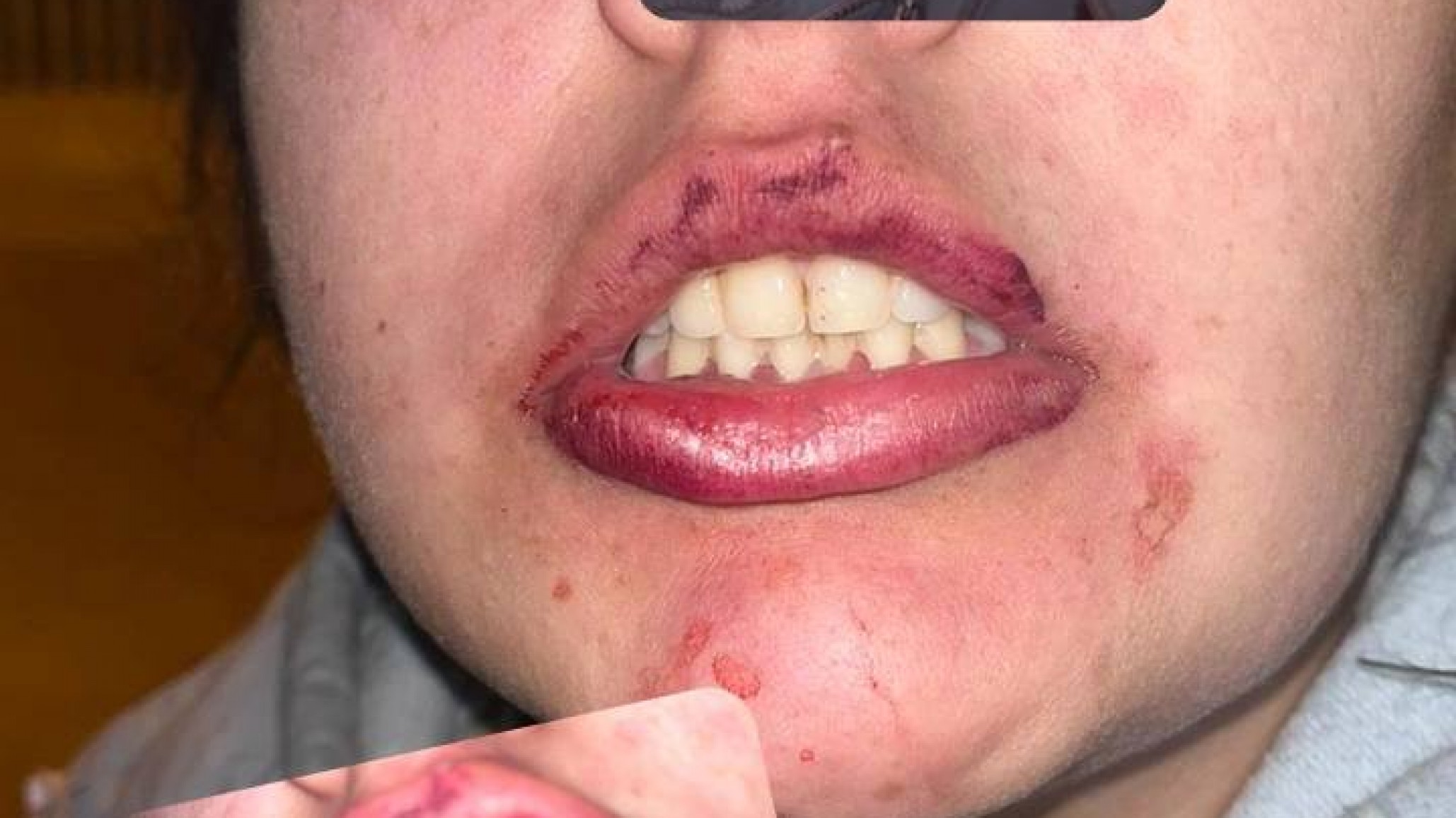 "Si me pasa algo, no fui yo": el desesperado pedido de una joven tras denunciar a su ex pareja por violencia