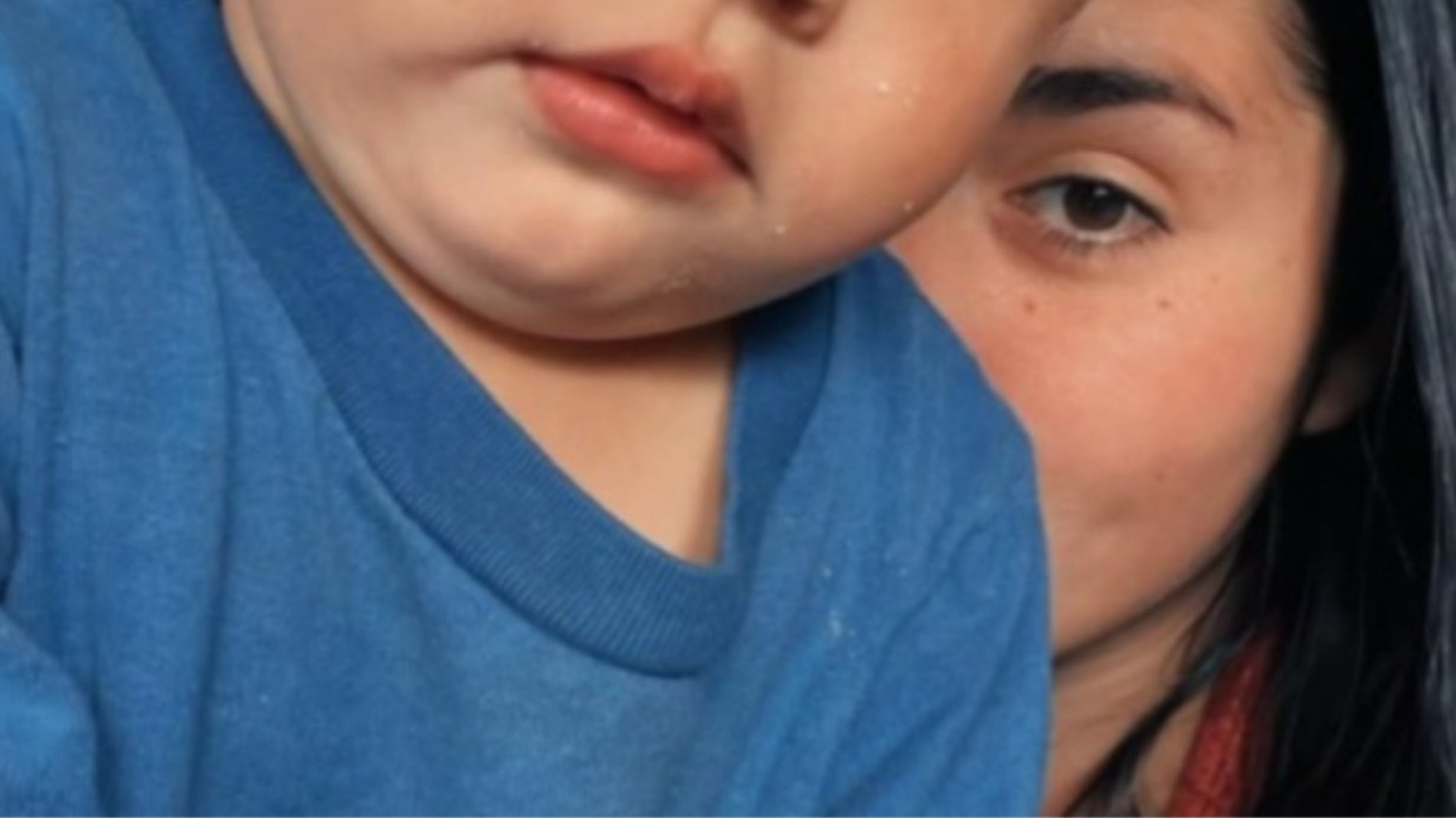 "Noah es fuerte": le amputaron un pie y ambas manos tras un accidente y su familia pide ayuda para conseguir prótesis