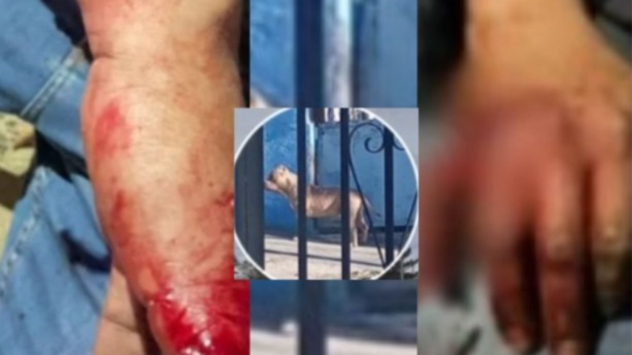 Lo arrastraron una cuadra: brutal ataque de dos pitbulls a un vecino