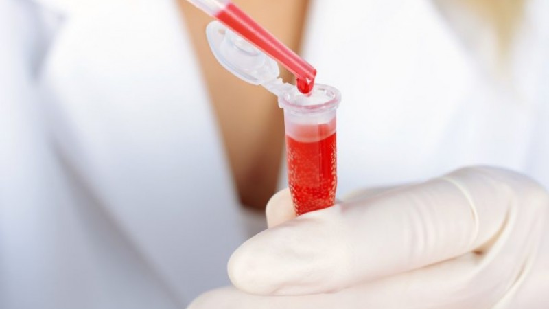 El gobierno nacional eliminó un subsidio clave y la Fundación de la Hemofilia está al borde del cierre