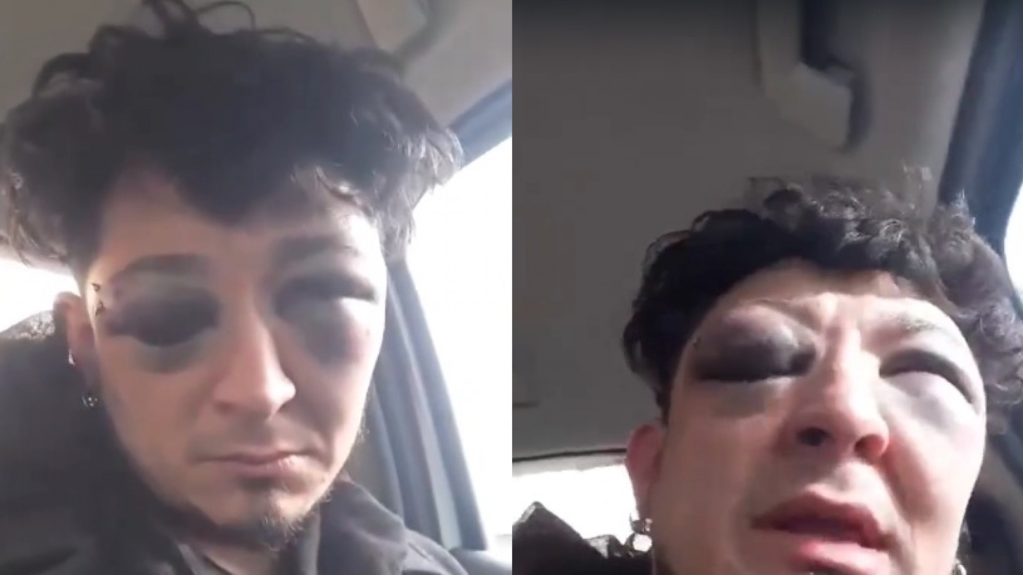 Pico Truncado: un vecino perdió un ojo y denunció en video que fue torturado por la policía