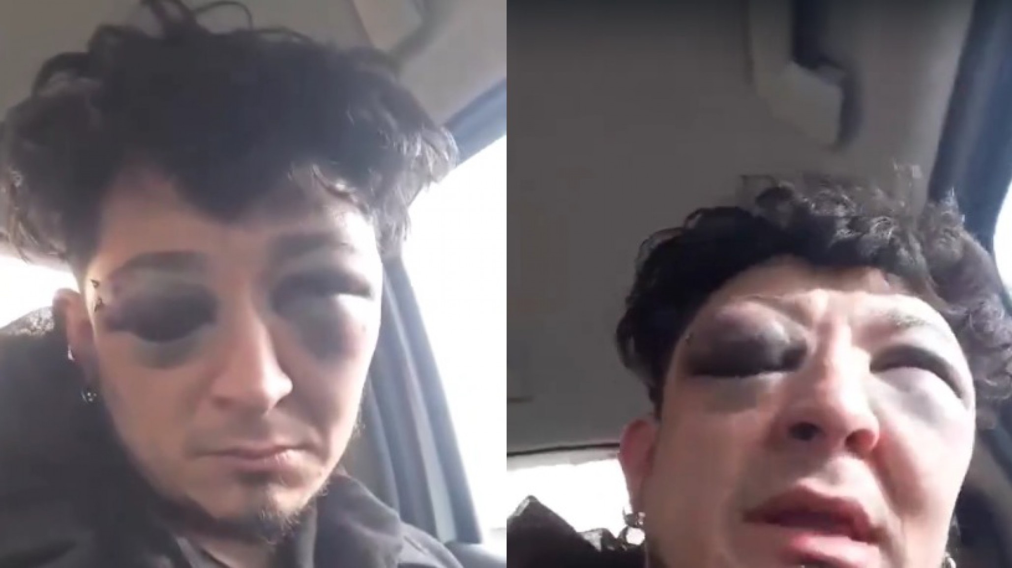 Pico Truncado: un vecino perdió un ojo y denunció en video que fue torturado por la policía