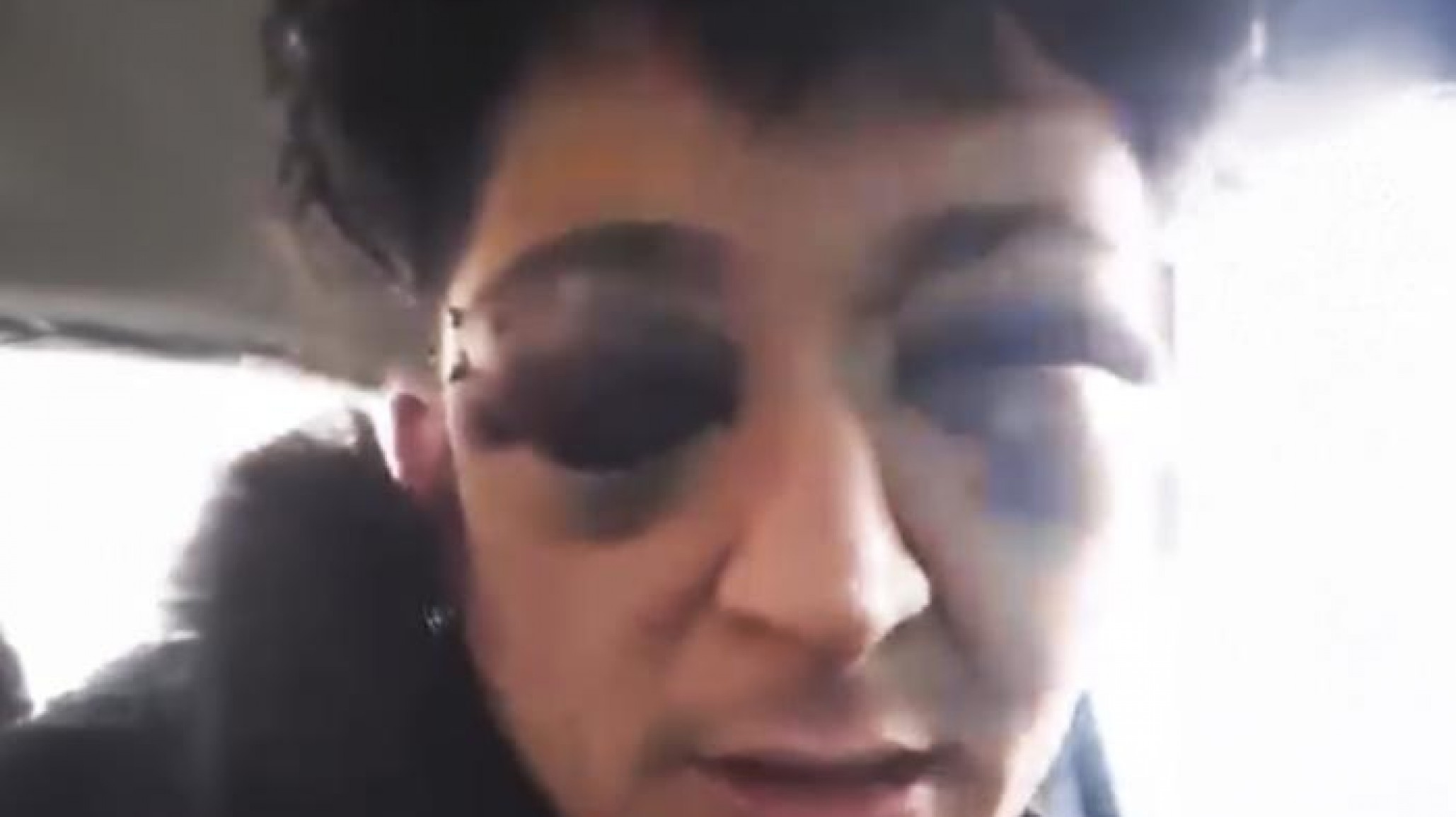 Músico golpeado en Pico Truncado: Ariel Carrizo aclaró que no se escapó y teme perder la visión de un ojo