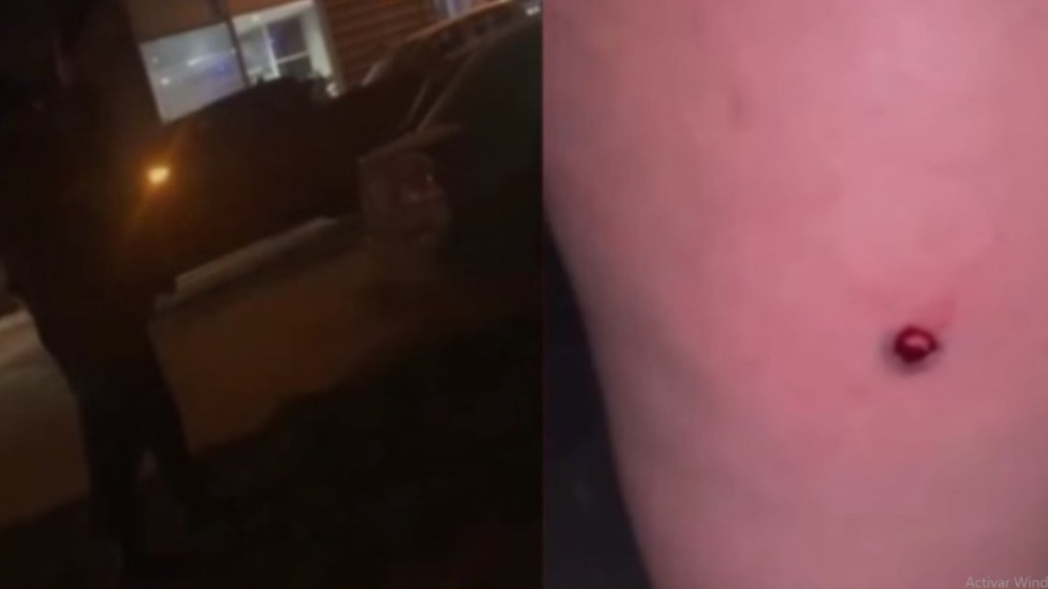 Descontrol a la salida de un boliche con disparos y una joven herida por perdigones