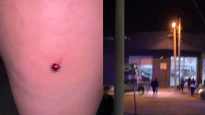 Tras los disturbios en Alta, se anunciaron más controles en boliches: "La noche es difícil, pero vamos a estar presentes"