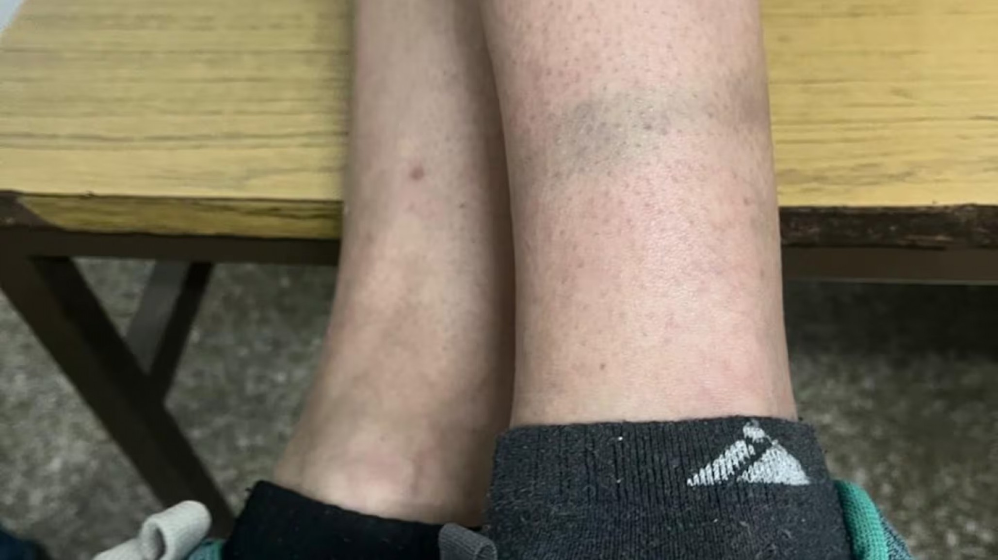 Córdoba: Una joven de 22 años logró escapar de su secuestrador y reveló un arsenal oculto