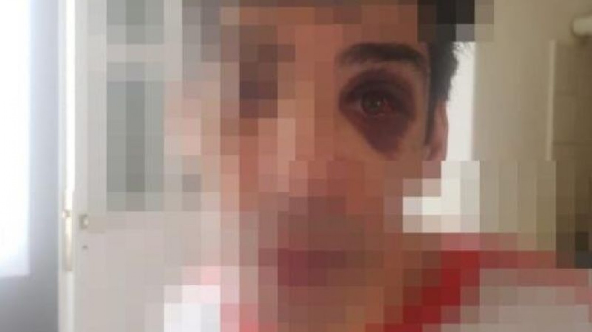 Así dejó un acompañante terapéutico a un joven con parálisis en Comodoro