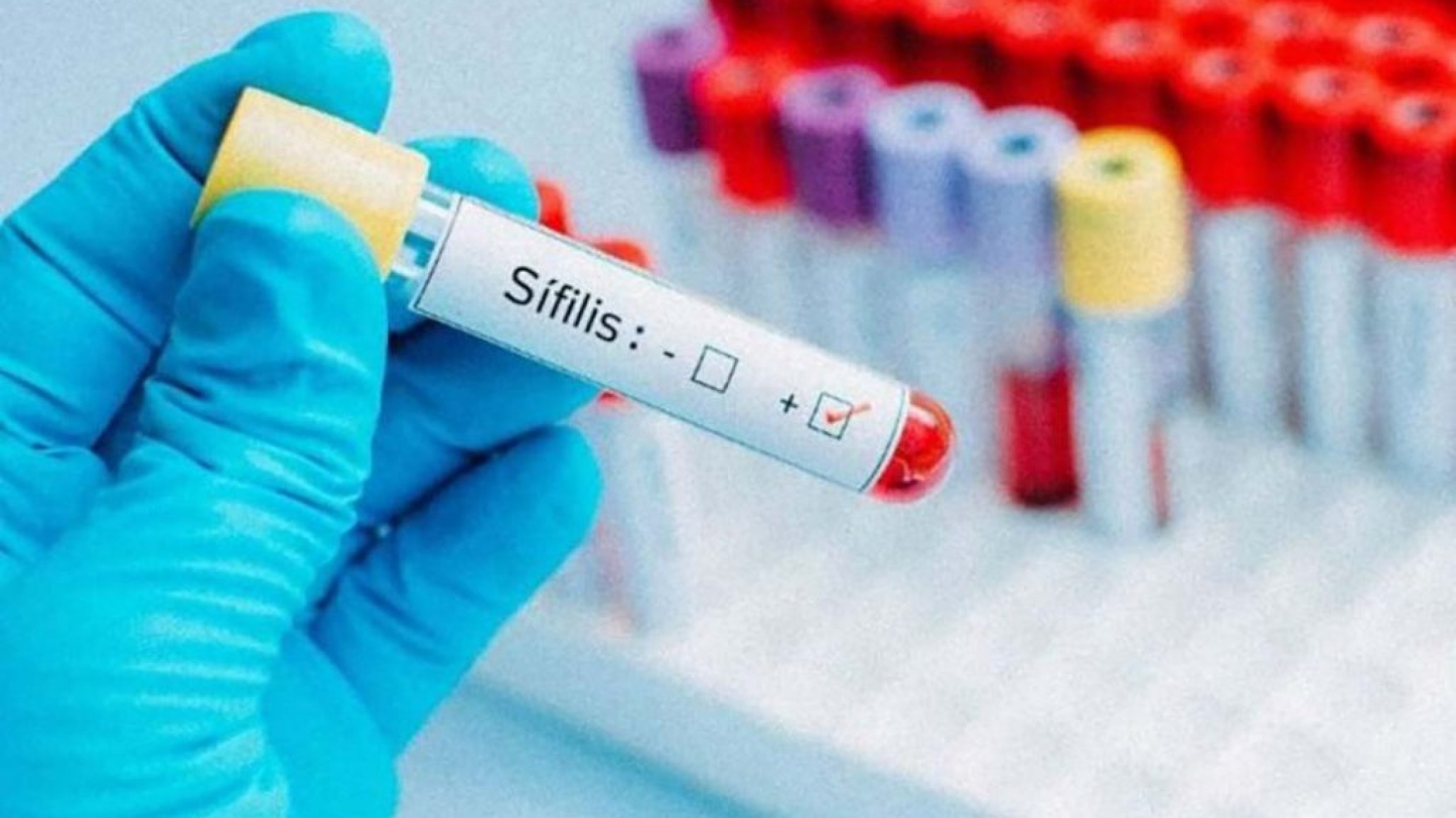 "Estamos en una oleada de aumento": alarma por 900 casos de sífilis en Comodoro en solo dos años