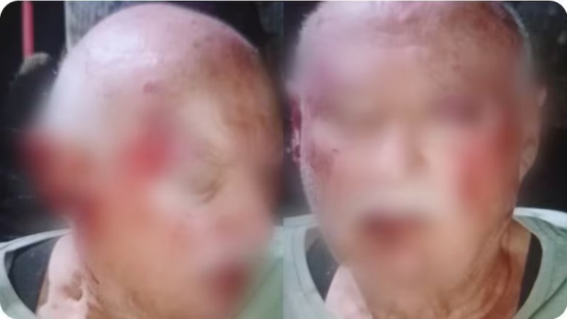 Horror: brutal ataque a una pareja de jubilados mientras tomaban mates en la vereda