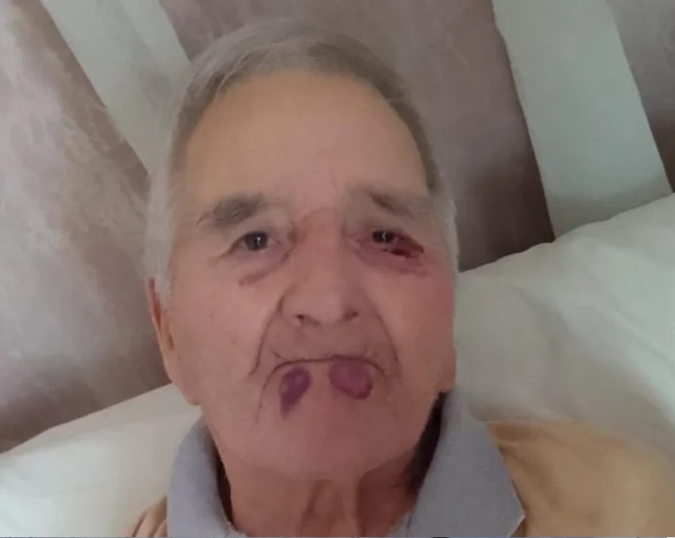 Escándalo en un geriátrico de Mar del Plata: Golpearon brutalmente a a un jubilado y fue hospitalizado