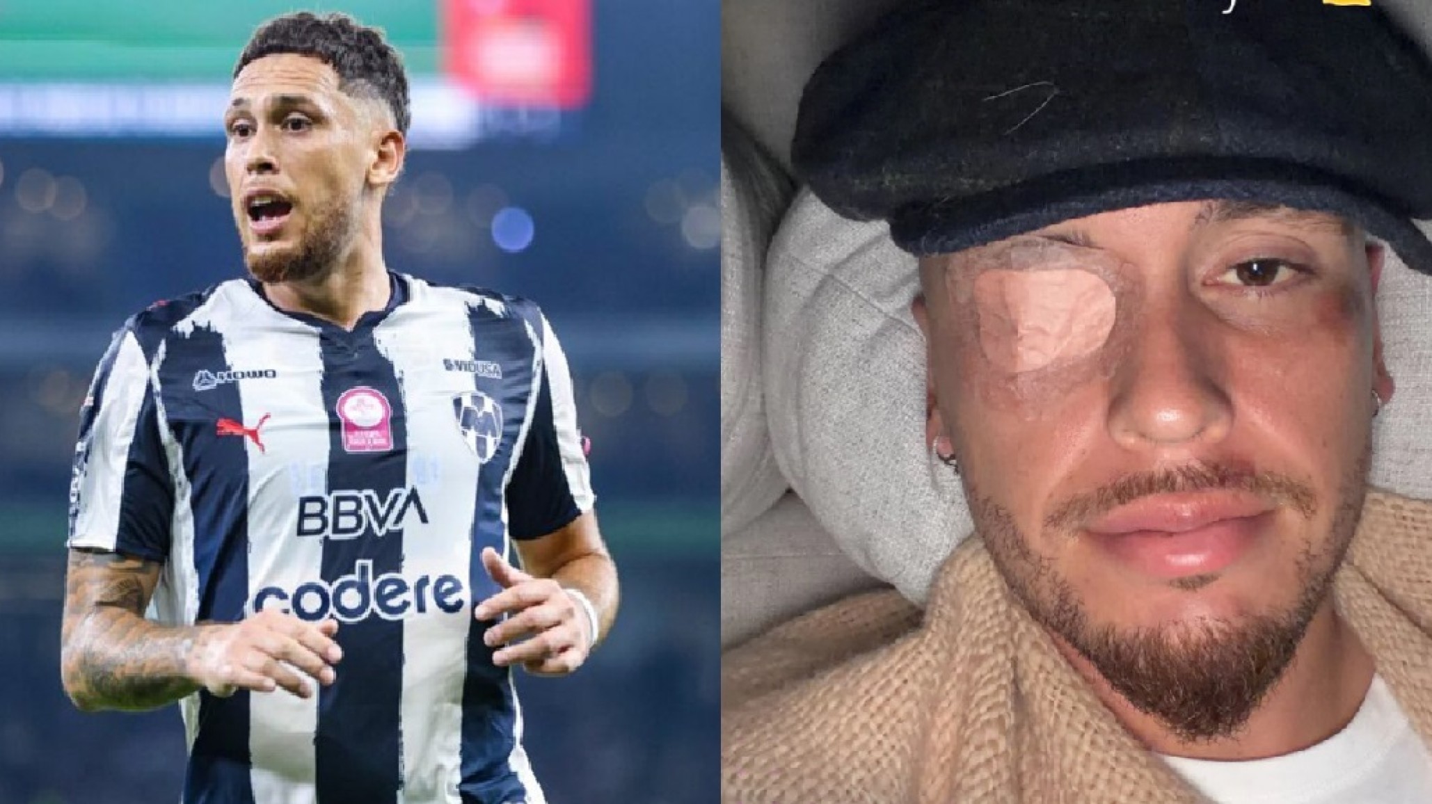 Lucas Ocampos sufrió una parálisis facial y se pierde la pretemporada Clausura 2026