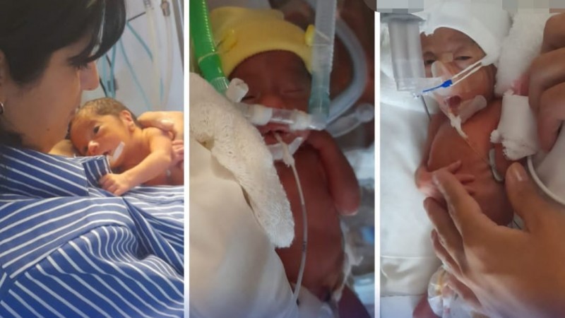 Nacieron en Buenos Aires las trigemelas idénticas de Río Gallegos: un caso médico excepcional como el de Trelew