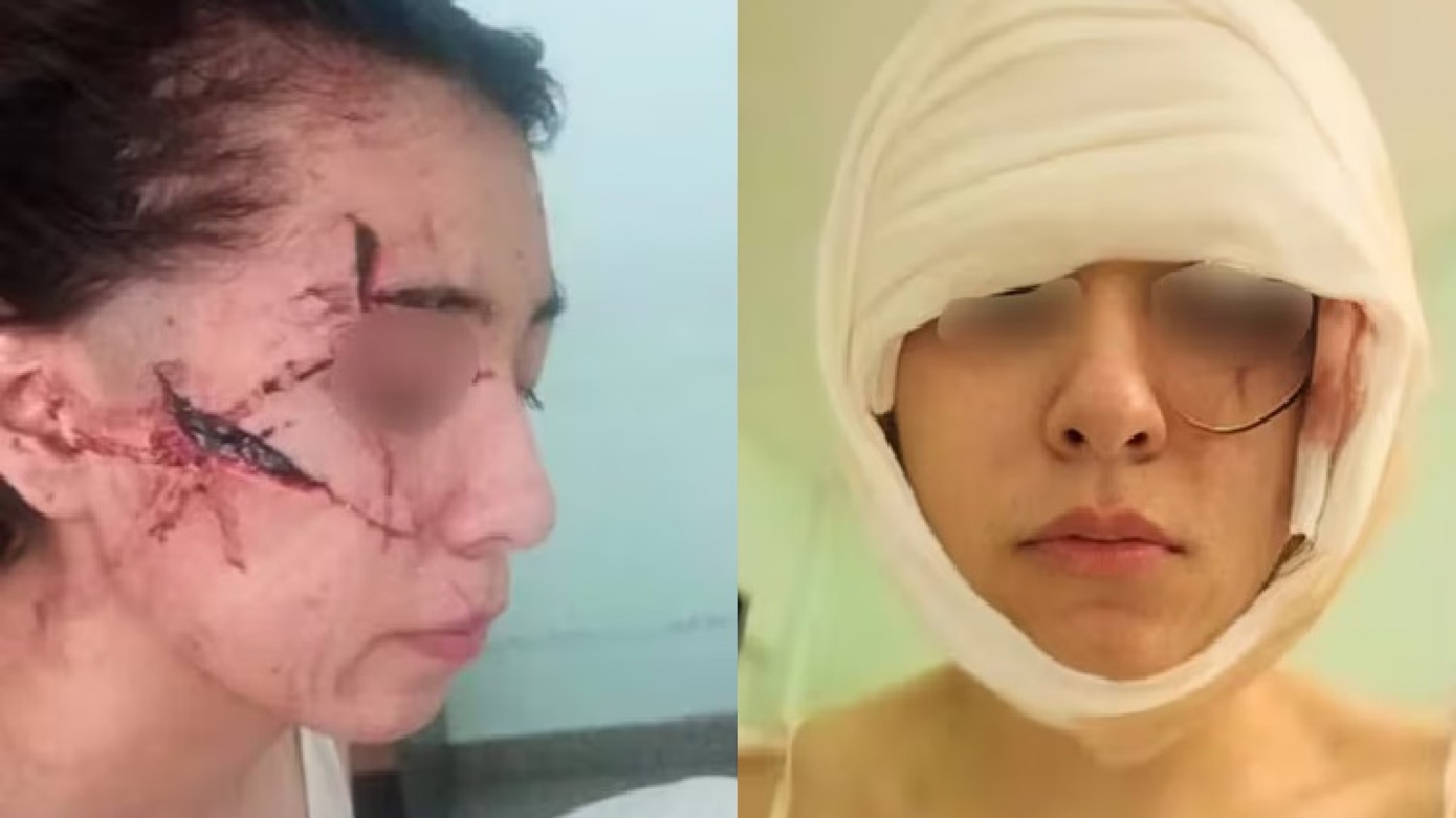 "Se graban cuando golpean": le cortaron la cara a una menor y quisieron degollar a una adolescente